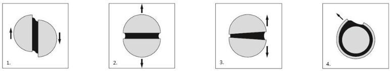 Load types on adhesive bonds